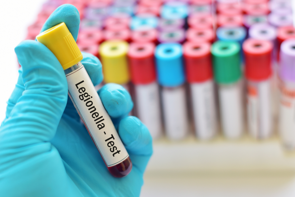 a blue gloved hand holds a test-tube titled legionella test, theres an array of colourfully lidded test-tubes lightly blurred in the background